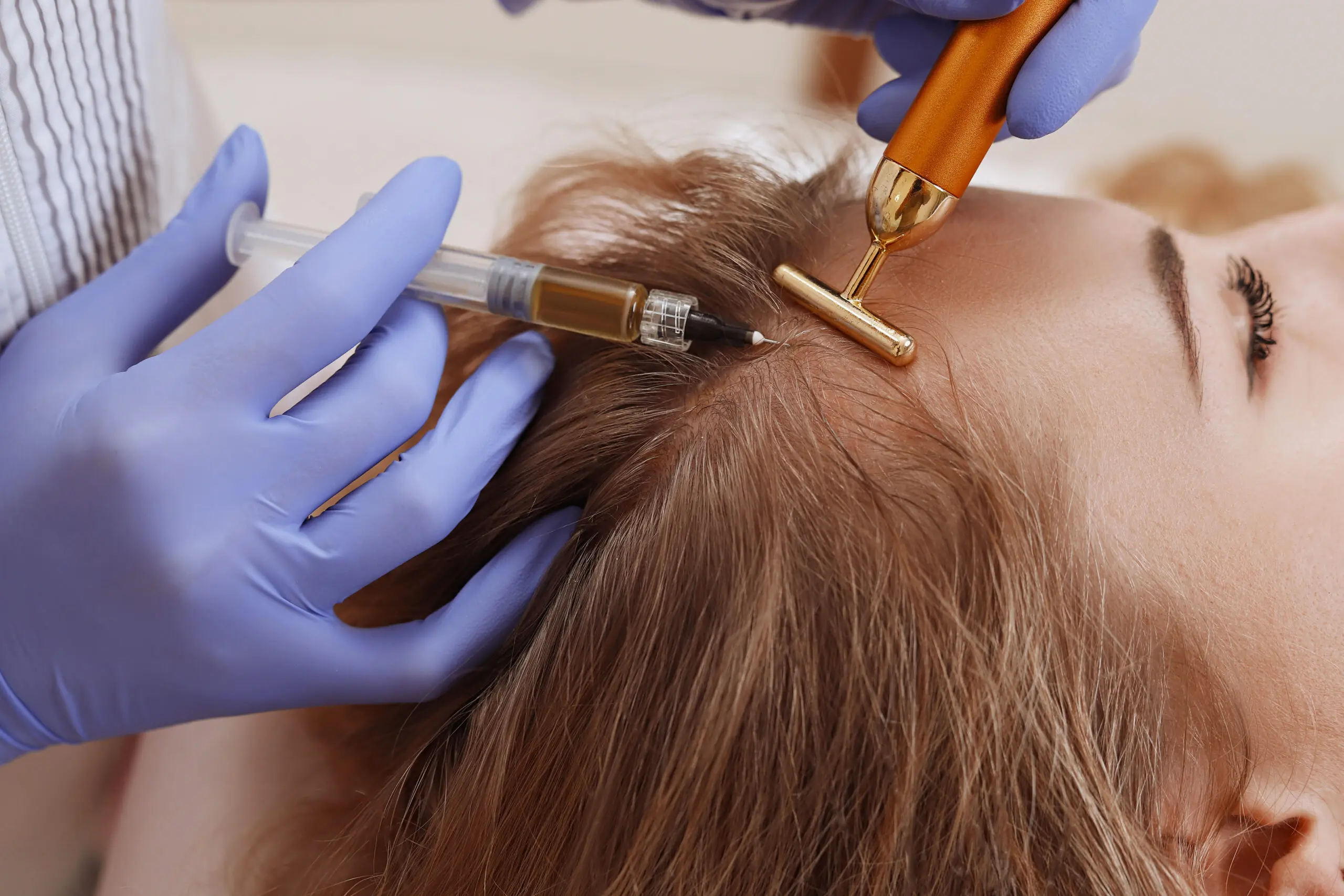 MESOTHERAPY AND PRP TRAINING